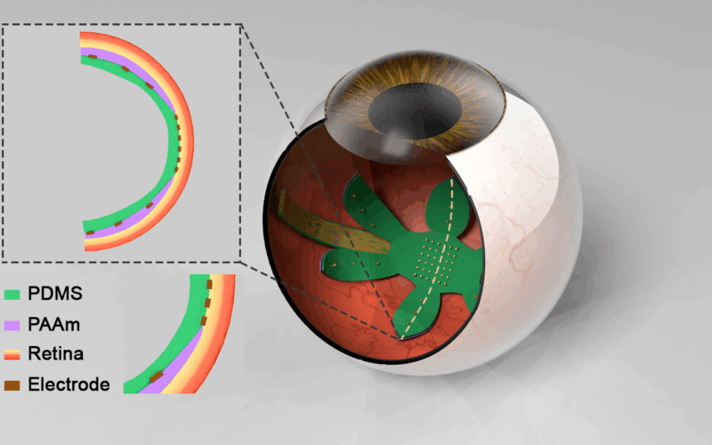 muru_fig_2 eyeball diagram